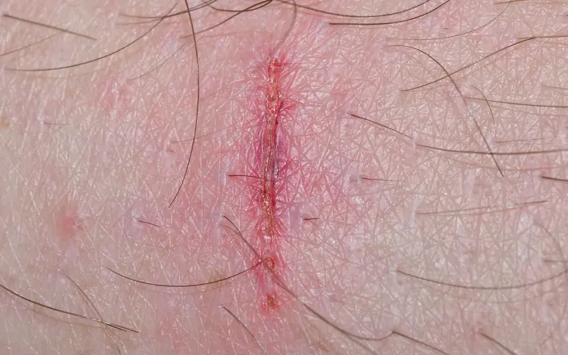 九月，愿你一切会更好！