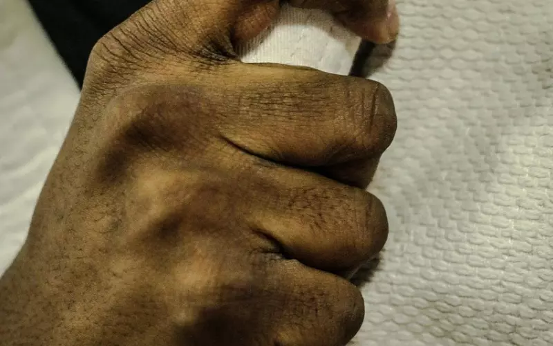 情感咨询：想挽回婚姻不妨试试柔道