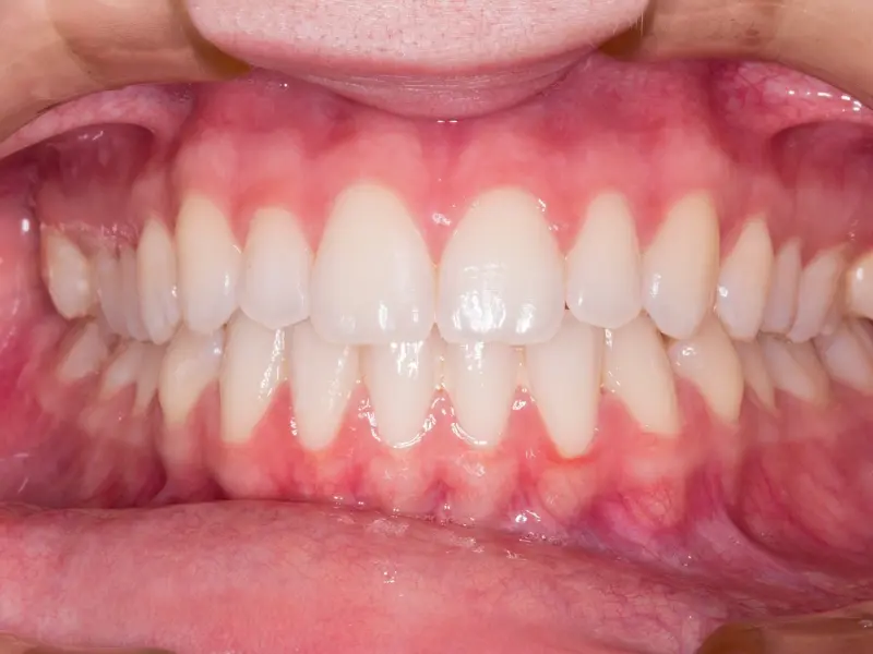 免费抢票 | 小柯剧场邀你看《百万约定》音乐剧，约吗？