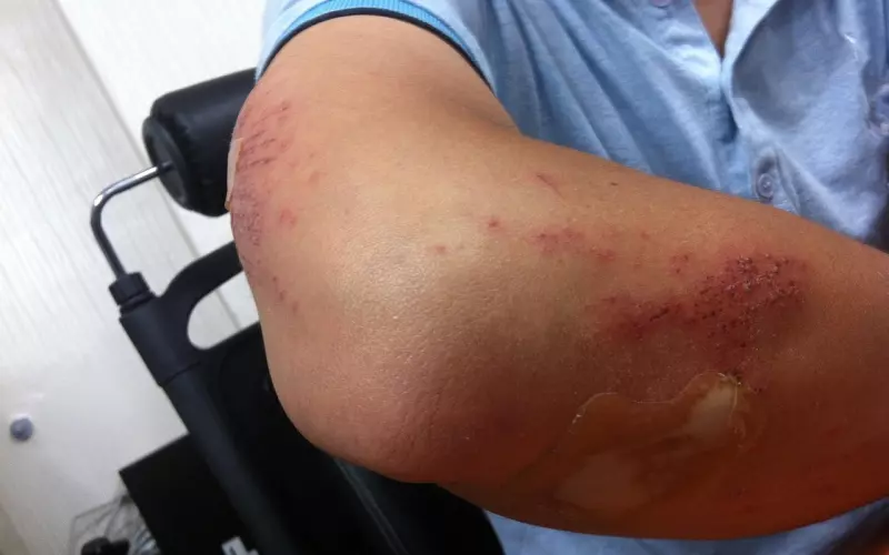 女人失恋了怎么治疗情伤